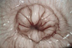 Vaginoscopia nella diagnosi di endometrite clinica della vacca